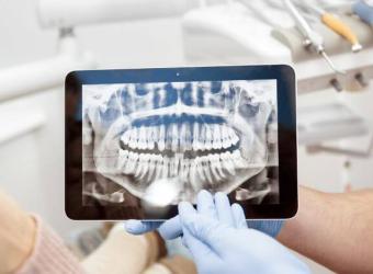 Are Dental X-Rays Safe? Debunking Myths and Addressing Concerns