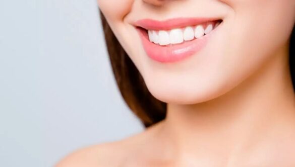 Top 5 Foods That Can Whiten Your Teeth Effectively