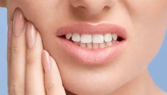 Best Natural Cures for Commonly Found Dental Issues