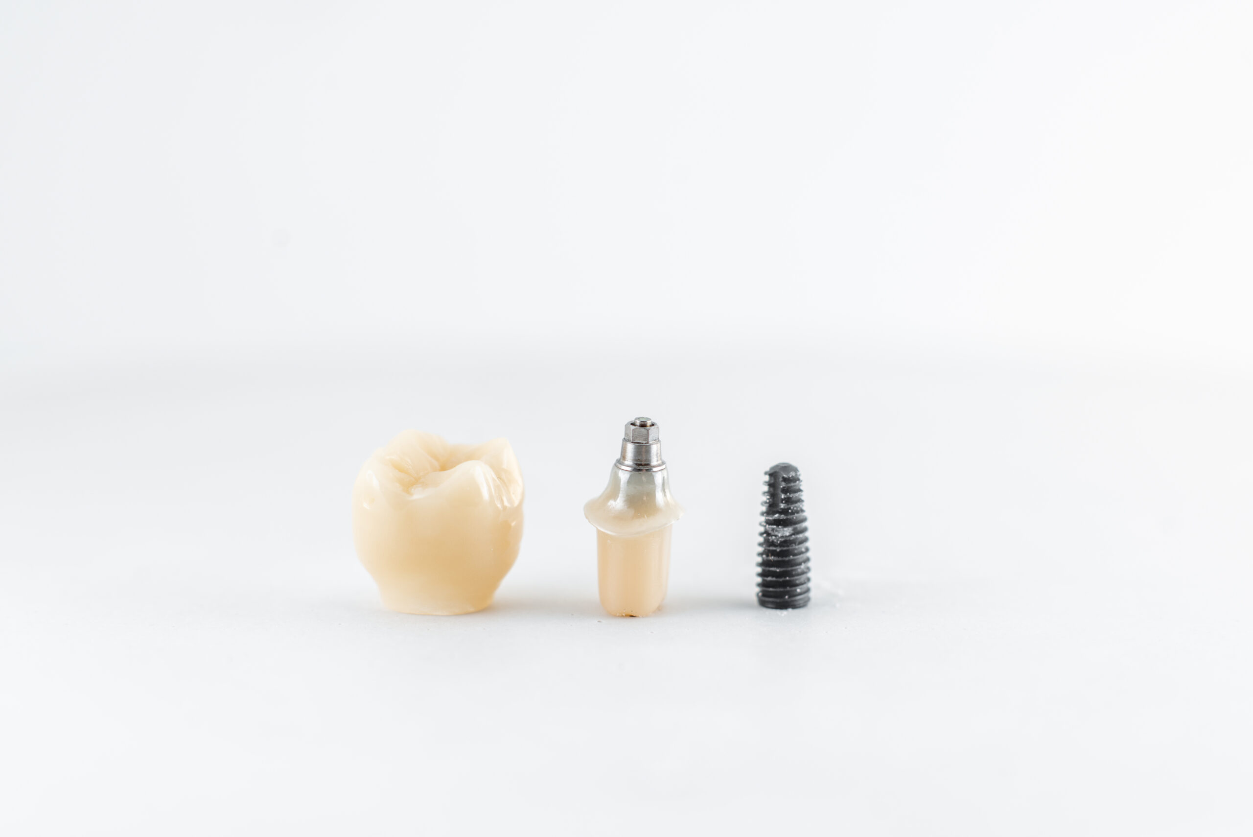 Dental implant with screw and crown